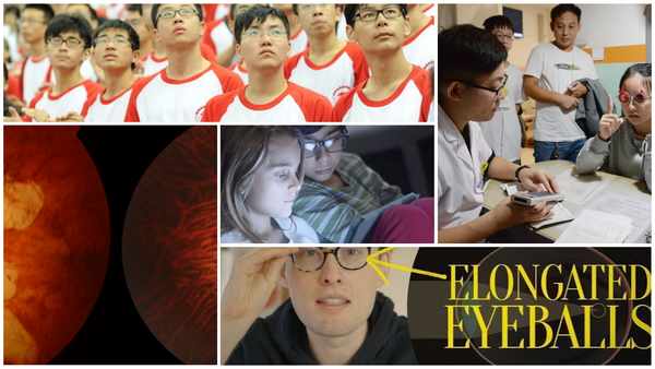 Myopia - So What?